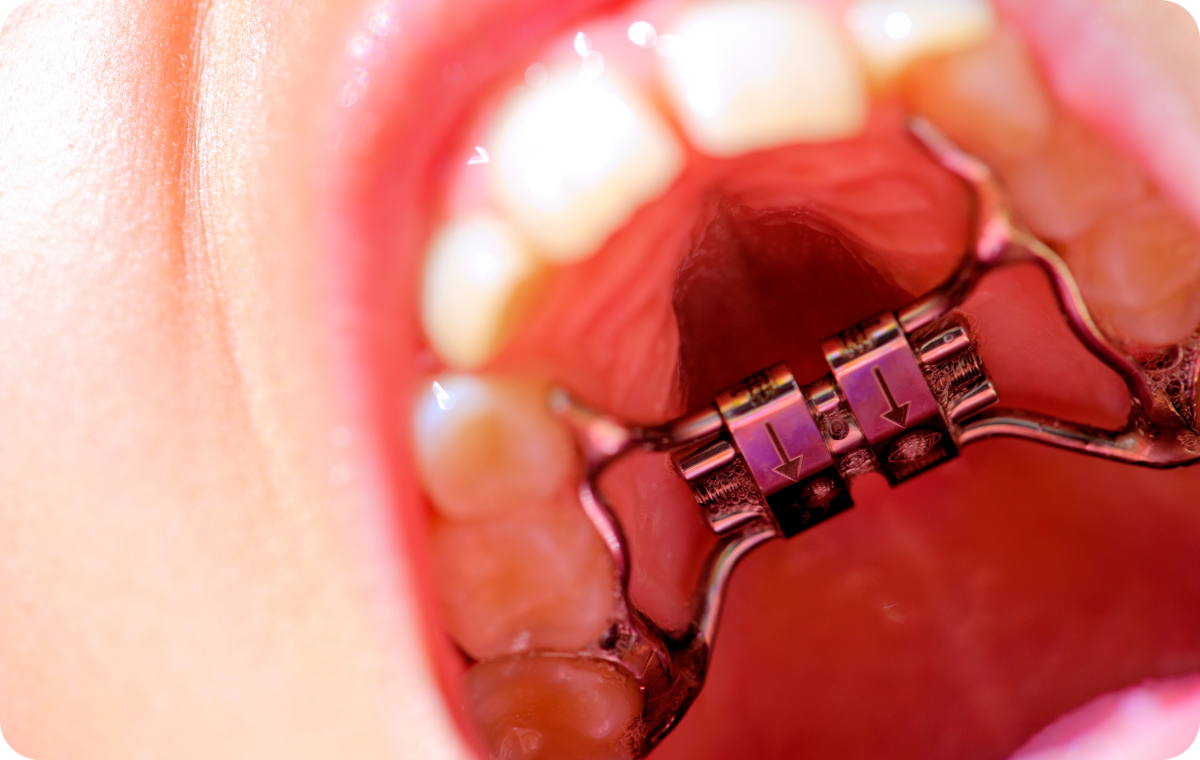 Nos conseils Dr Déborah Fellous, Orthodontiste à Charenton-le-Pont