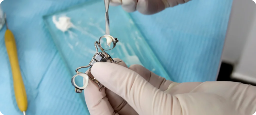 Activation d'un disjoncteur Dr Déborah Fellous | Orthodontiste à Charenton-le-Pont